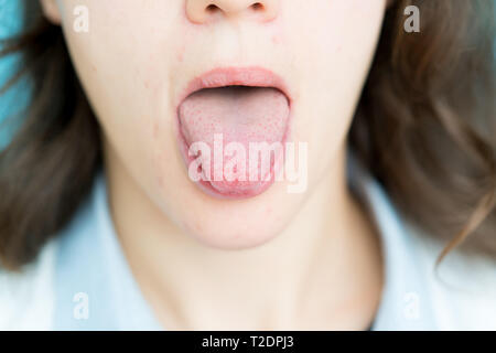 Junge Frau mit Pille auf der Zunge Stockfoto
