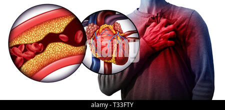 Myokardinfarkt, wie eine Person, die von einem Herzinfarkt aufgrund verstopfter Koronararterien als Kardiologie not Symbol mit 3D-Darstellung. Stockfoto