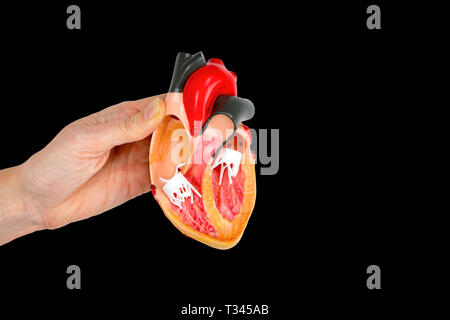 Hand, Modell öffnen menschlichen Herzen auf schwarzem Hintergrund Stockfoto