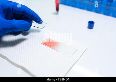 Wissenschaftler vorbereiten Blutprobe für die Forschung am Mikroskop. Die Blutprobe auf Objektträger. Wissenschaft und Medizin Konzept. Stockfoto