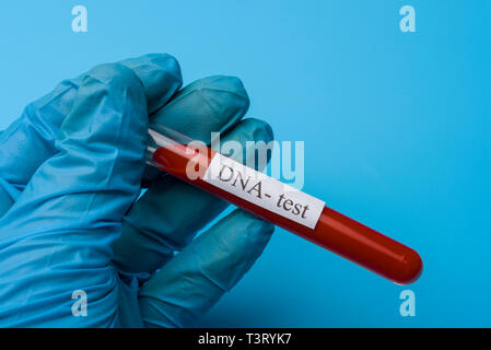 Hand mit einem DNA-Test in einem Reagenzglas auf blauem Hintergrund. Das Konzept von Medizin und Analyse. Stockfoto