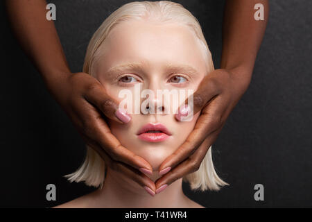 Dunkelhäutige Hände mit hellrosa Nägel berühren weißes Gesicht Stockfoto
