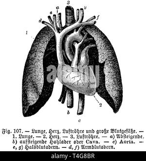 Die menschliche Lunge, Herz, die Luftröhre und die großen Blutgefäße. 1) Lunge, 2) Herz, 3) Luftröhre. a), b) aufsteigend absteigend Arterie oder Cava, c) Aorta, e, g) zervikaler Venen, d, f) brachial Venen, anonym 1887 Stockfoto