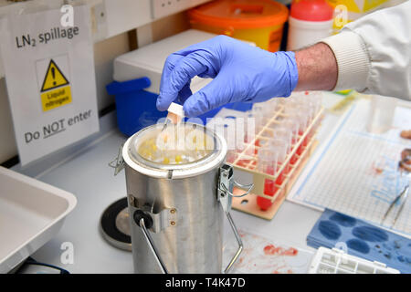 Hinweis: ANSTÖSSIGE INHALTE ALS MENSCHLICHE GEWEBE werden SEZIERT menschliche Gewebe sind in flüssigem Stickstoff in einem medizinischen klinischen Labor an der Universität von Bristol basierte eingefroren. PRESS ASSOCIATION Foto. Bild Datum: Montag, 8. April 2019. Photo Credit: Ben Birchall Stockfoto