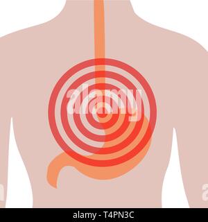 Magenschmerzen im menschlichen Körper. Bauchschmerzen. Sodbrennen. Disoder des Verdauungssystems Stock Vektor
