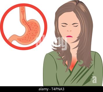 Gastroösophagealer Reflux Krankheit. Gerd Magen in einem menschlichen Körper Vector Illustration auf weißem Hintergrund Stock Vektor