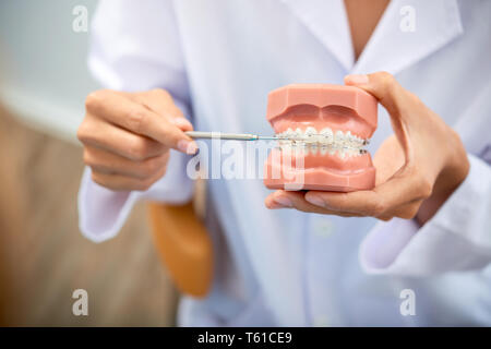 Kunststoffbacken mit Klammern in den Händen des Zahnarztes Stockfoto