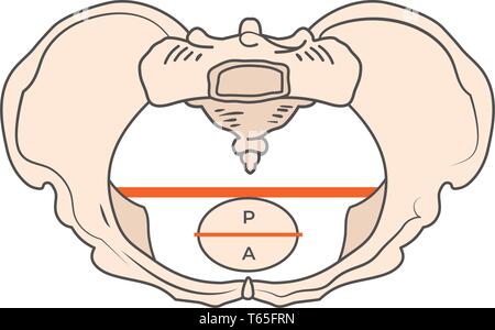 Platypoid/Platypelloid Becken Form mit runden oder runde Form Stock Vektor