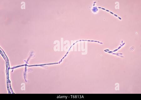 Der Photomicrograph conidiophores und die Konidien des Pilzes Fusarium verticillioides, 1978. Bild mit freundlicher Genehmigung Zentren für Krankheitskontrolle und Prävention (CDC)/Dr Libero Ajello. () Stockfoto