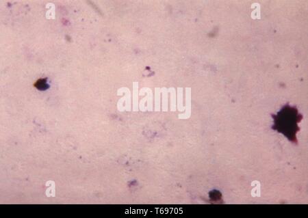 Dickschicht photomicrograph einer jungen wachsenden Plasmodium malariae trophozoite, 1965. Bild mit freundlicher Genehmigung Zentren für Krankheitskontrolle und Prävention (CDC)/Dr Mae Melvin. () Stockfoto