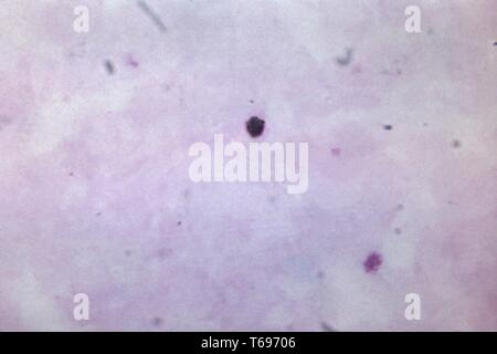 Dickschicht photomicrograph eines wachsenden Plasmodium malariae trophozoite, 1965. Bild mit freundlicher Genehmigung Zentren für Krankheitskontrolle und Prävention (CDC)/Dr Mae Melvin. () Stockfoto