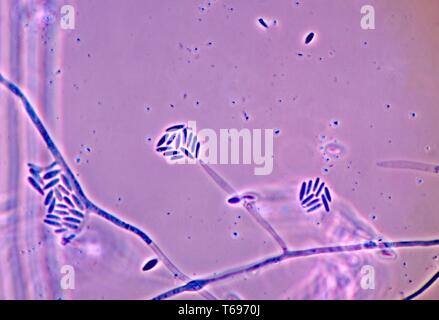 Photomicrograph der Konidien und conidiophores des Pilzes Fusarium verticillioides, 1978. Bild mit freundlicher Genehmigung Zentren für Krankheitskontrolle und Prävention (CDC)/Dr Libero Ajello. () Stockfoto