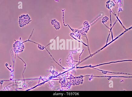 Photomicrograph der Konidien und conidiophores des Pilzes Fusarium verticillioides, 1978. Bild mit freundlicher Genehmigung Zentren für Krankheitskontrolle und Prävention (CDC)/Dr Libero Ajello. () Stockfoto