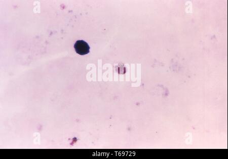 Giemsa Fleck Thick Film photomicrograph eines Plasmodium malariae gametocyte, 1969. Bild mit freundlicher Genehmigung Zentren für Krankheitskontrolle und Prävention (CDC)/Dr Mae Melvin. () Stockfoto