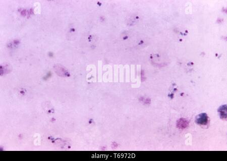 Giemsa Fleck Thick Film photomicrograph eines Plasmodium vivax Ringe und eine alte trophozoite, 1971. Bild mit freundlicher Genehmigung Zentren für Krankheitskontrolle und Prävention (CDC)/Dr Mae Melvin. () Stockfoto