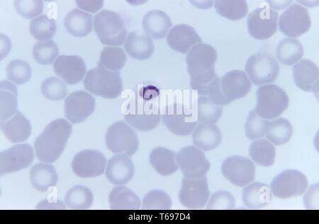 Giemsa Fleck photomicrograph eines kompakten Plasmodium malariae trophozoite, 1973. Bild mit freundlicher Genehmigung Zentren für Krankheitskontrolle und Prävention (CDC)/Dr Mae Melvin. () Stockfoto