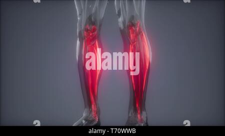 Gastrocnemius - Sichtbare Muskel Anatomie Karte Stockfoto