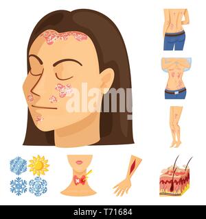 Psoriasis, Schneeflocke, endokrinen, Verletzung, Haut, Körper, fallen, System, arm, Epidermis, chronischen, Eis, Hals, Fettgewebe, Allergie, Ekzem, Juckreiz, Winter, Anatomie, Blut, Gewebe, Stress, Hautausschlag, Infektion, Schnee, Peeling, Schneefall, menschlich, Hand, Pore, juckende, Mädchen, gefroren, Schmerzen, Dermatologie, Krankheit, Gesundheitswesen, medizinische, Set, Vector, Icon, Illustration, isoliert, Sammlung, Design, Element, Grafik, Zeichen, Cartoon, Farbe Vektor Vektoren, Stock Vektor