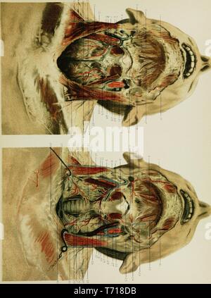 Illustrierte chirurgische Öffnen eines menschlichen männlichen Hals, aus dem Buch "Regionale Anatomie in ihrem Bezug zur Medizin und Chirurgie" durch McClellan George, 1891. Mit freundlicher Genehmigung Internet Archive. () Stockfoto