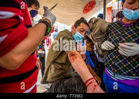 Überlebende mit Wunden kam für Hilfe an einer medizinischen Zelt, nach dem Erdbeben der Stärke 7.8, in Bhaktapur Durbar Square in Kathmandu Tal, das ist ein Stockfoto