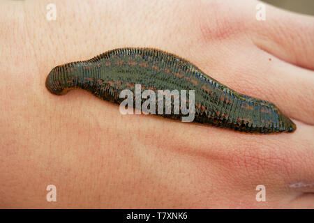 Medizinische Blutegel - Hirudo medicinalis - Blutegel beißen, Leech ist das saugen Blut auf den menschlichen Körper (Hand). Stockfoto