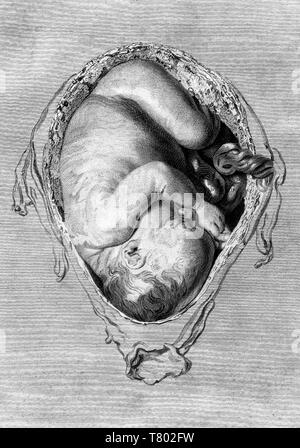 William Hunter, Anatomia uteri humani gravidi, 1774 Stockfoto