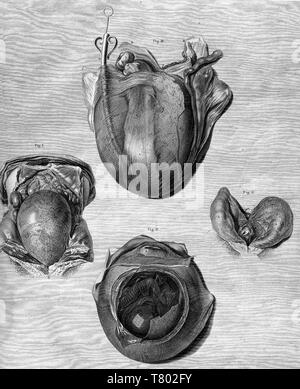 William Hunter, Anatomia uteri humani gravidi, 1774 Stockfoto