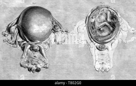 William Hunter, Anatomia uteri humani gravidi, 1774 Stockfoto