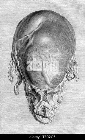 William Hunter, Anatomia uteri humani gravidi, 1774 Stockfoto