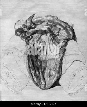 William Hunter, Anatomia uteri humani gravidi, 1774 Stockfoto