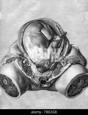 William Hunter, Anatomia uteri humani gravidi, 1774 Stockfoto