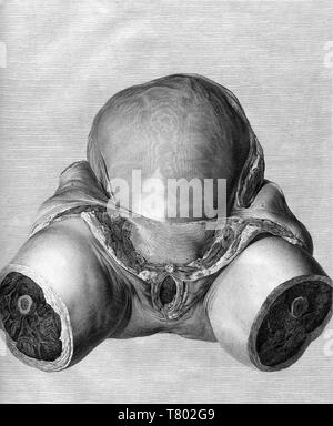 William Hunter, Anatomia uteri humani gravidi, 1774 Stockfoto