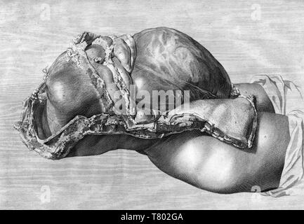 William Hunter, Anatomia uteri humani gravidi, 1774 Stockfoto