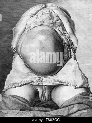 William Hunter, Anatomia uteri humani gravidi, 1774 Stockfoto