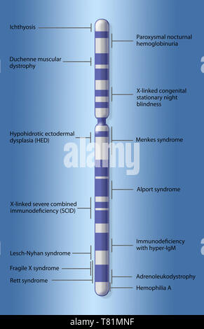 X-Chromosom Karte von Krankheit, Abbildung Stockfoto