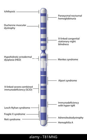 X-Chromosom Karte von Krankheit, Abbildung Stockfoto
