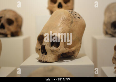 Länglicher Schädel von alten Paracas Menschen Stockfoto