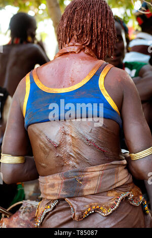 Wunden von whiplash Öffnen während der Stier springen Zeremonie, Hamar Stamm, Äthiopien Stockfoto