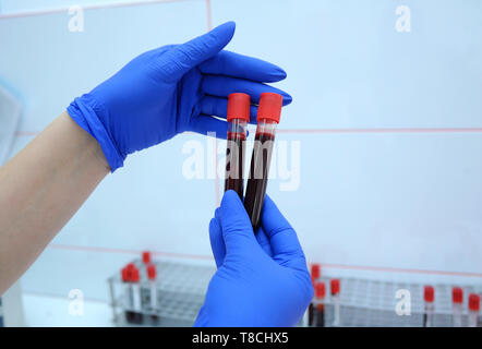 Lab Assistant, vacutainers mit Blut von den vergeblichen Innen Stockfoto