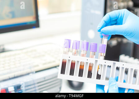 Arzt hand Entnahme einer Blutprobe Rohr aus einem Rack mit Maschinen der Analyse im Labor Hintergrund/Techniker holding Blut tube test im Research Co Stockfoto