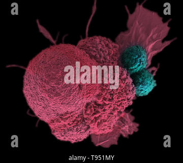 Diese Electron Micrograph (SEM) zeigt eine oral squamous cancer Cell (rot), die angegriffen wurde durch zwei zytotoxische T-Zellen (blau). Der tumor-spezifischer T-Zellen vom eigenen Immunsystem des Patienten entwickelt wurden, eine personifizierte Impfstoff gegen Krebs wie jene, die in der Zukunft mit Hilfe standardisierter Menschenrechte der NIST Genome entwickelt werden können. Dieses Bild hat eingefärbt worden. Stockfoto