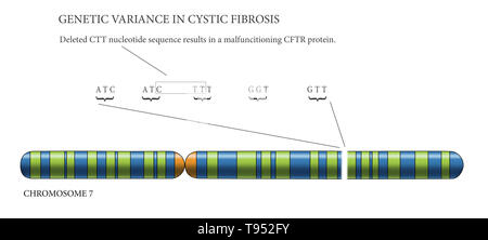 Zystische Fibrose Chromosom, Illustration. Mukoviszidose ist eine genetische Störung, die vor allem die Lunge, sondern auch die Bauchspeicheldrüse, Leber, Nieren und Darm. Es ist durch die Anwesenheit von Mutationen in beiden Kopien des Gens für die Cystic Fibrosis Transmembrane Conductance Regulator Protein verursacht. Stockfoto