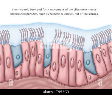 Medizinische Illustration, Cilia und Schleim. Die rhythmische Hin und Her Bewegung der Zilien bewegen Schleim und eingefangenen Partikel, wie Bakterien und Viren, aus den Nebenhöhlen. Stockfoto