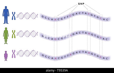 Single nucleotide Polymorphism (SNP) spielt eine Rolle bei einer Vielzahl von Krankheiten wie Sichelzellenanämie und Mukoviszidose. Stockfoto