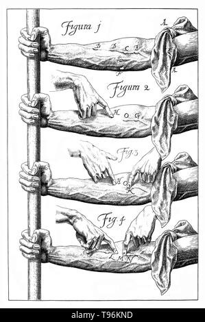 Schematische Darstellung William Harvey's Experimente auf die Ventile der Adern; nach einer Zeichnung von S. Gooden für die nonesuch Ausgabe von De motu cordis, London: 1928. William Harvey (April 11, 1578 - Juni 3, 1657) war ein englischer Arzt. Harvey war die erste Person, die genau bestimmen zu können, wie das Herz das Blut im gesamten Körper von Mensch und Tier verbreitet und war auch der Erste, der die Theorie, dass Menschen und andere Säugetiere reproduziert, wenn ein Ei von Spermien befruchtet zu vermuten. Stockfoto