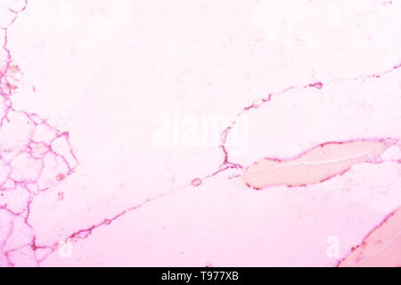 Rot, orange und rosa Marmor Muster, mit weißen Hintergrund mit rosa Adern, oder Körner, im Marmor Schiefer. Das ist ein Schnitt Marmor Schiefer. Stockfoto