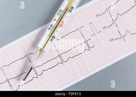 Auflistung der Elektrokardiogramm und Quecksilber Thermometer. Stockfoto