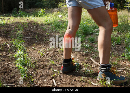 Frau mit Krampfadern auf eine Wanderung. Red dot Effekt. Stockfoto