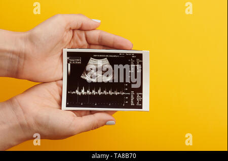 Ultraschall Bild von Baby in Frau Bauch in Händen Nähe zu sehen. Stockfoto