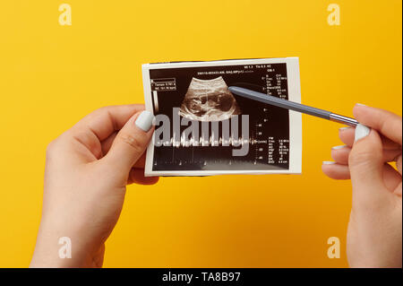 Surfen Ultraschall Foto. Kontrolle Scan der schwangeren Frau Stockfoto